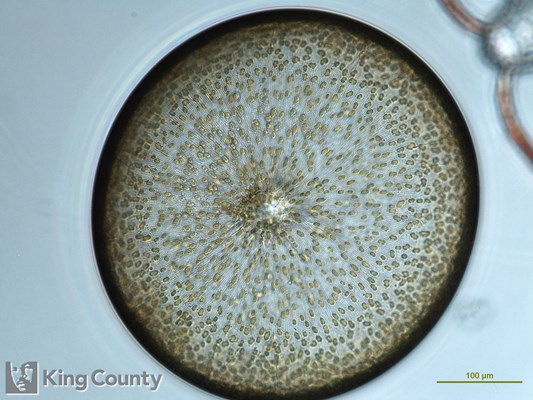 Photo of Coscinodiscus wailesii